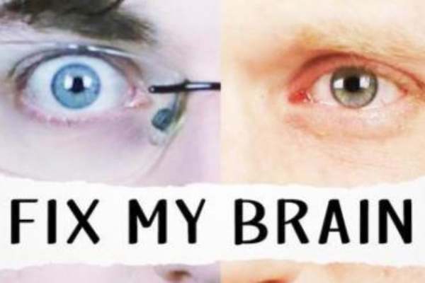 Fringe REVIEW: Fix my Brain @The Warren