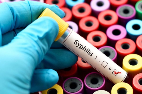 Gay and bi men most at risk as syphilis rates soar