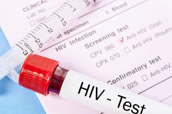 HAVE YOUR SAY: Open letter asks that Government’s opt-out testing programme is extended to all areas with a high prevalence of HIV