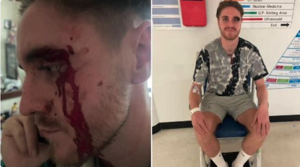 Six men arrested after suspected homophobic hate crime in which a gay man was attacked with a plank of wood