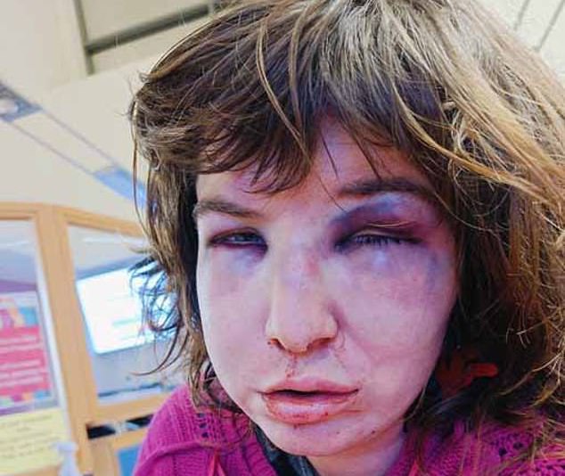 Trans woman suffers “brutal attack” in Coventry